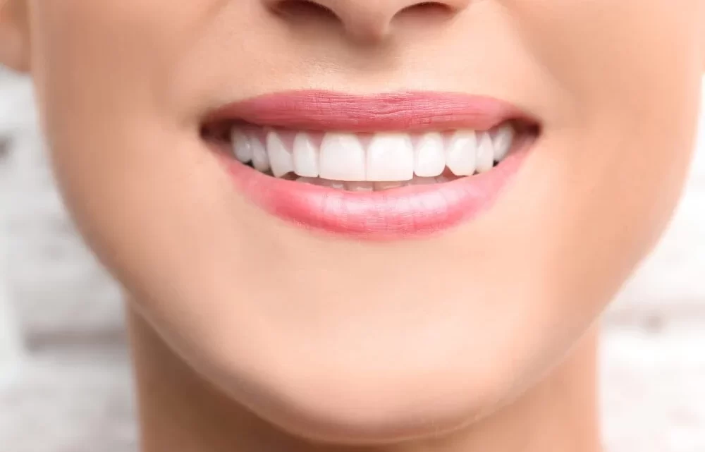 Unveiling the Hidden Benefits of Private Dental Care Solutions