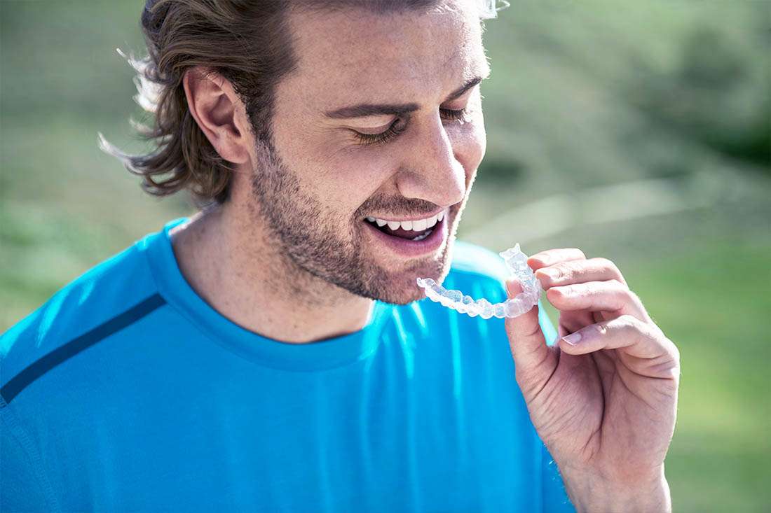 Invisalign: The Smart Path to Personalised Orthodontic Solutions