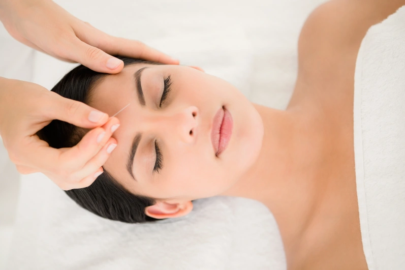 Acupuncture and Facial Rejuvenation